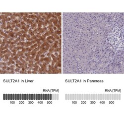 Cytosolic Sulfotransferase 2A1/SULT2A1 Antibody, Novus Biologicals:Antibodies:Primary